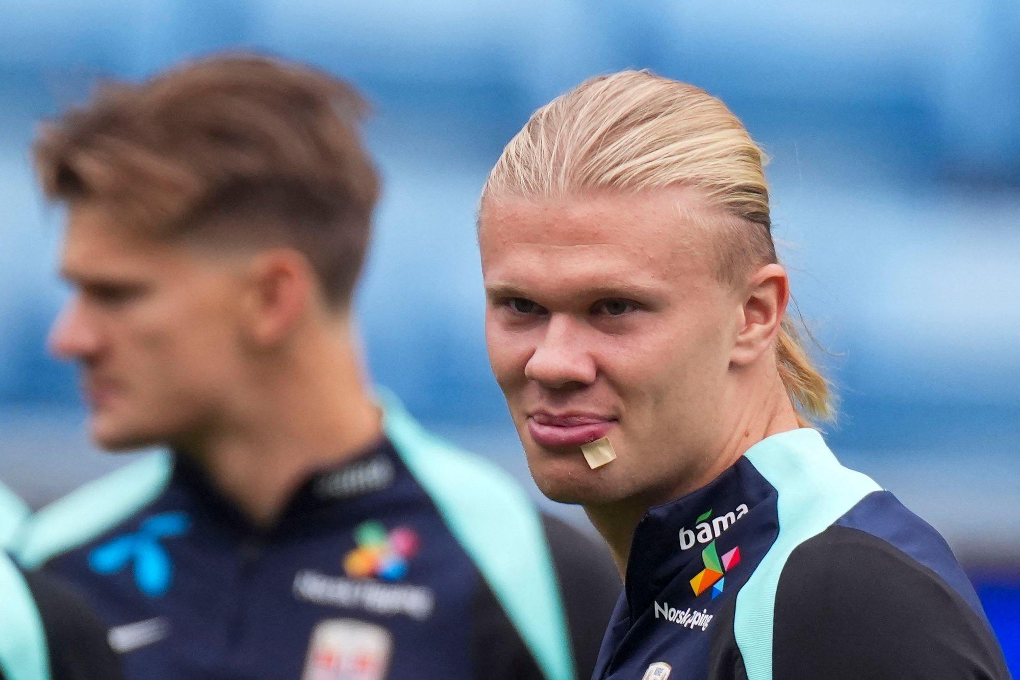 Hålandi nägu kohtus Norra koondise bussiga. Tulemuseks kolm õmblust