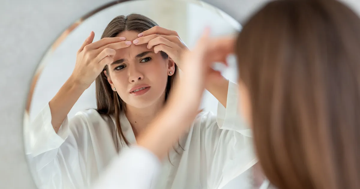 EKSPERDID PALJASTAVAD ⟩ Need on täiskasvanute akne tegelikud põhjused