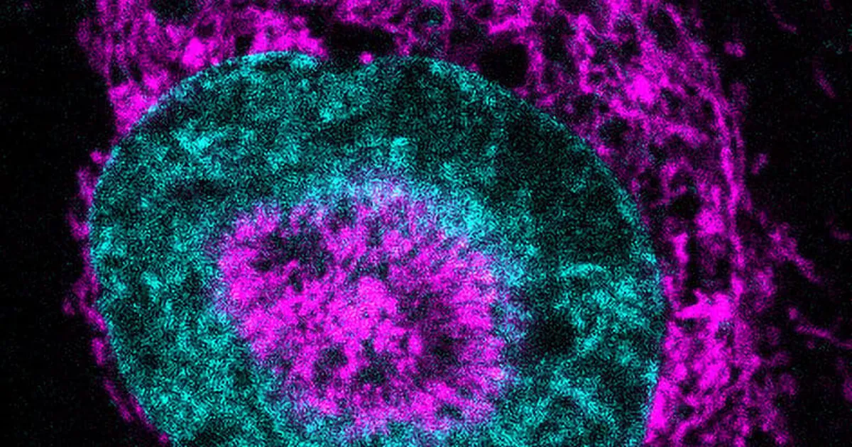 Teadlased leidsid üles vähi energiaallika ja oskaksid seda ka välja lülitada