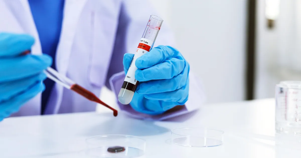 Uus vereproov annab müstilise haiguse diagnoosimisel lootust miljonitele