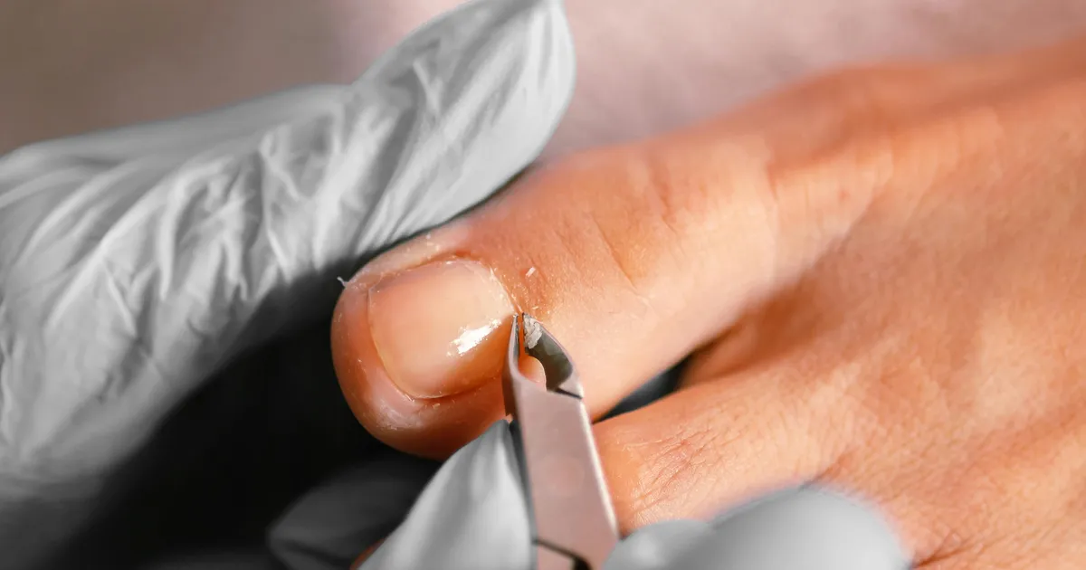 VIDEO LISATUD ⟩ Kas teadsite: just varbaküüntesse koguneb mürk, mis põhjustab surmava haiguse