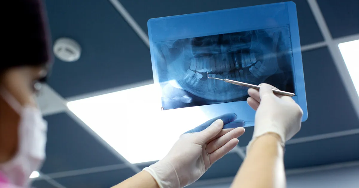 Jaapanis leiti tüvirakud, millest kasvavad hambad