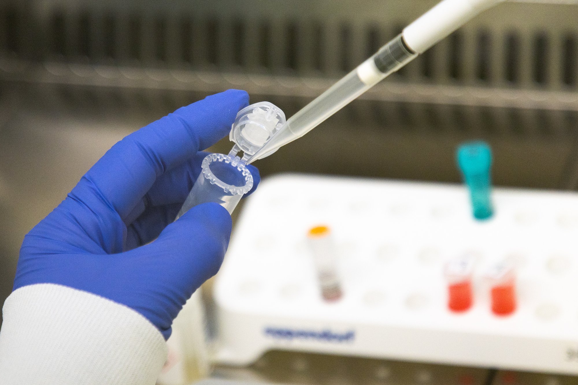 Gripi tipphooaeg võib tulla tavapärasest varem, tõenäoliselt juba novembris