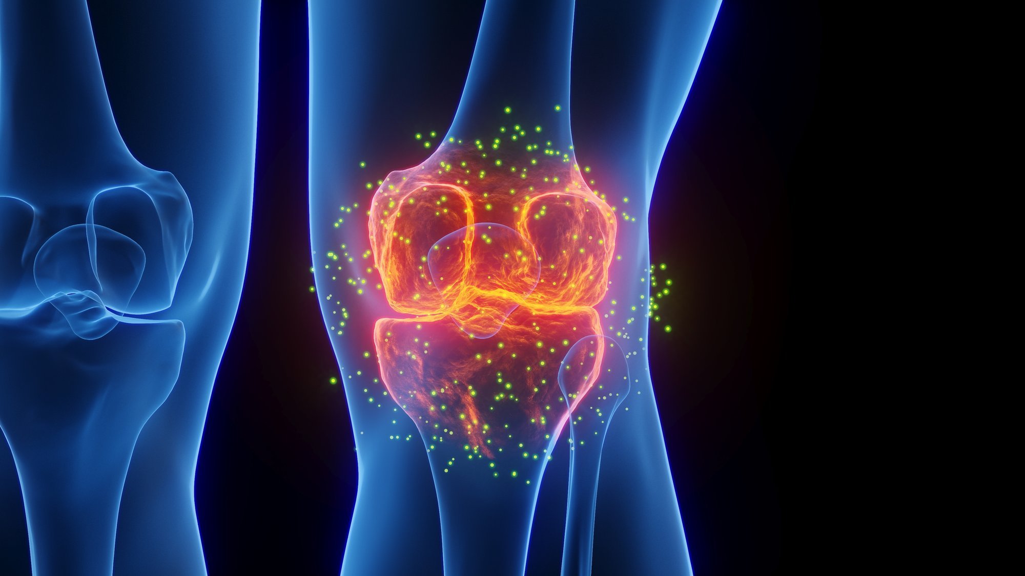 Alusta oma liigeste eest hoolitsemist enne, kui nad valutama hakkavad. Mis hoiab liigesed kaua terved?