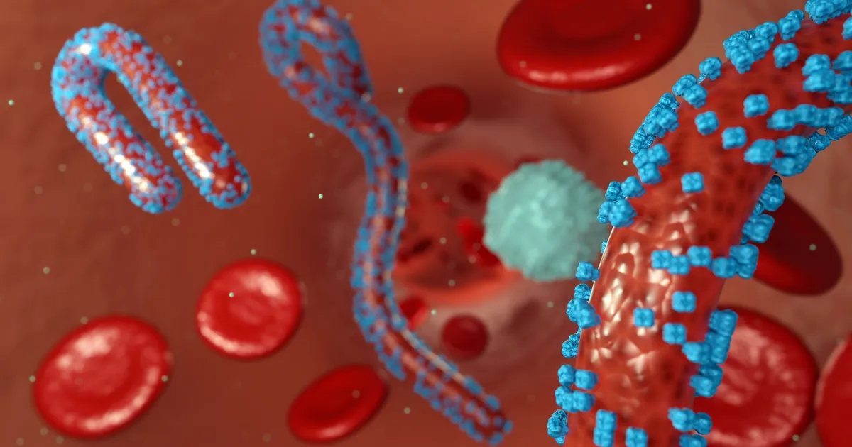 Etioopias leidis kinnitust Marburgi viiruse puhang