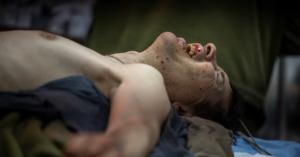 ŠOKEERIV ⟩ Ukraina rindel levib Esimese maailmasõja surmatõbi