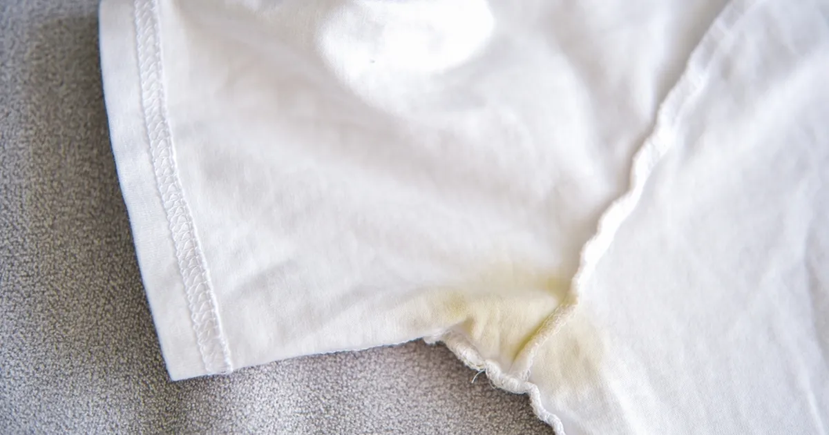 Kollased higiplekid ei taha kaduda? Üks lihtne kodune vahend teeb imet