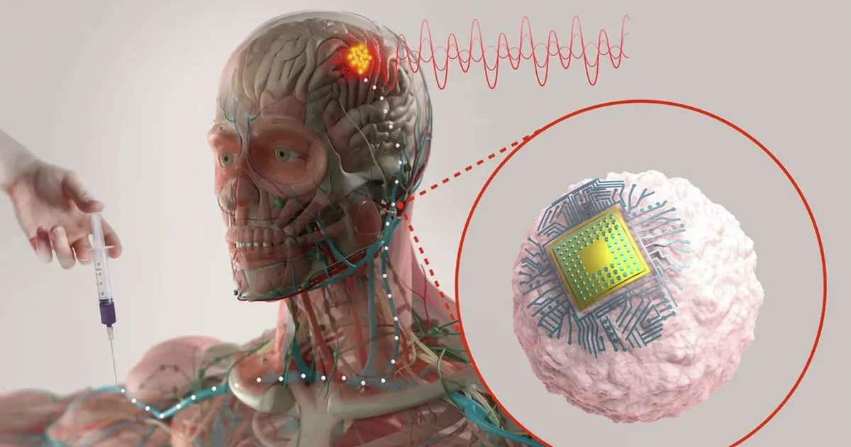 Unustage kolju puurimine: teadlaste uued küborg-verelibled liiguvad ajju seestpoolt