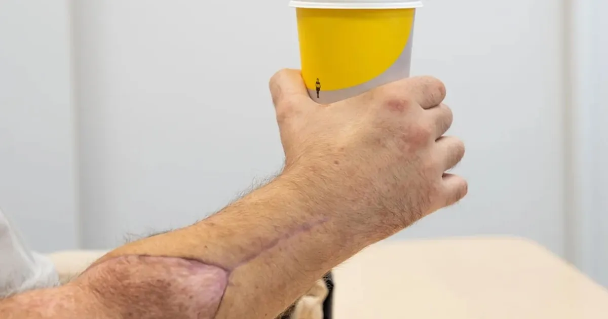 MEDITSIINIIME ⟩ Mehele siirdati korraga kaks kätt ja ta juba kirjutab ühega