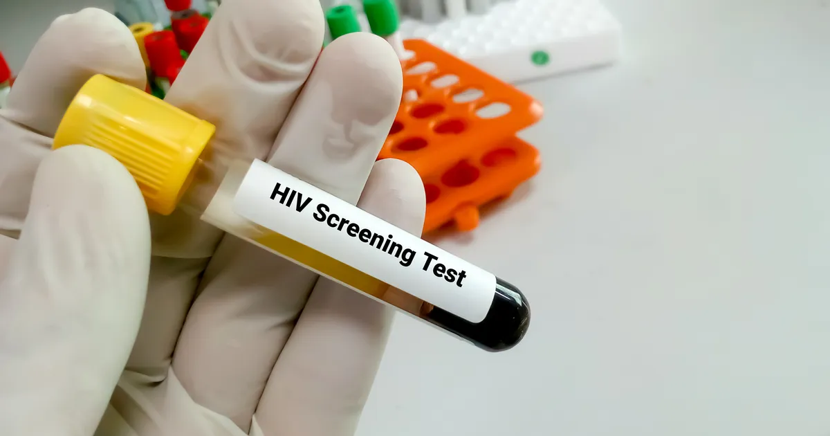 Tallinnas ja Narvas saab tasuta HIV-testi teha − vaata, kus ja kuidas