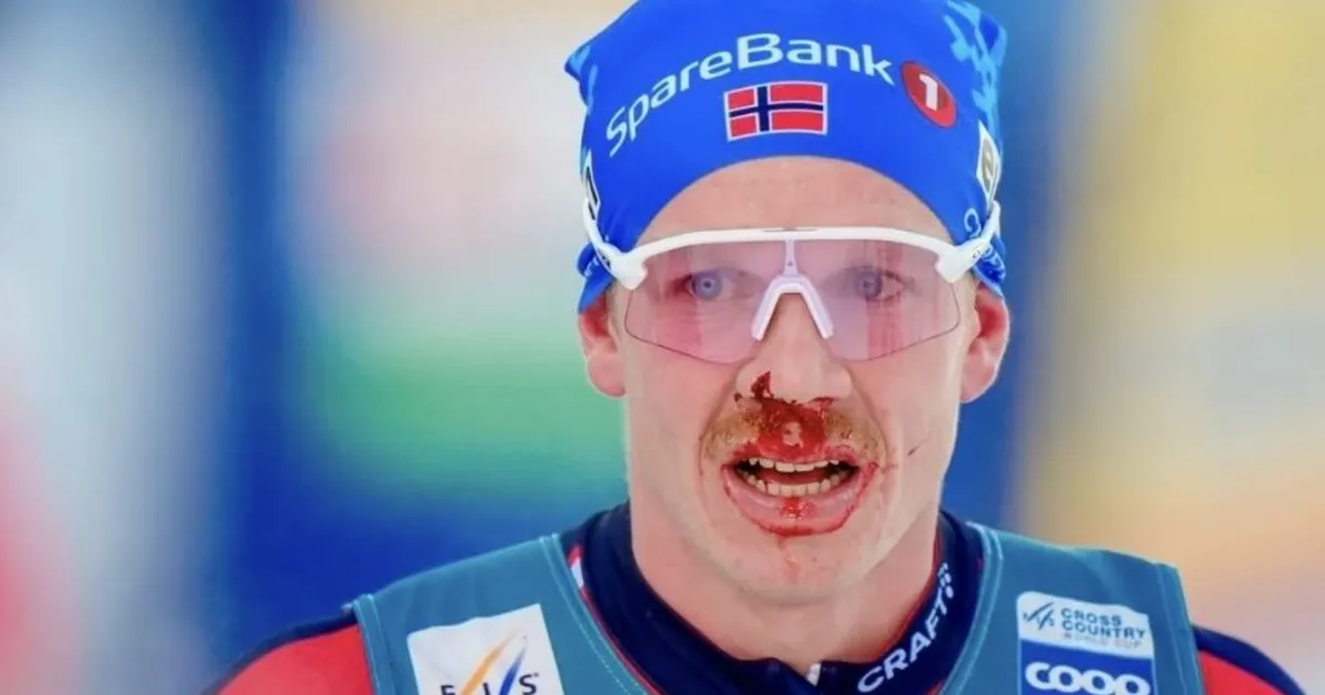Norra suusataja jõudis finišisse verise ninaga: õnneks olid prillid ees
