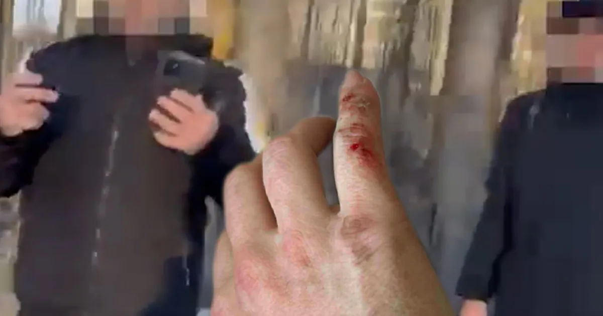 VIDEO JA FOTOD ⟩ Õismäel pipragaasirünnaku ohvriks langenud naine jäi abita: häirekeskus võttis info vastu, ent politseid ei saadetud