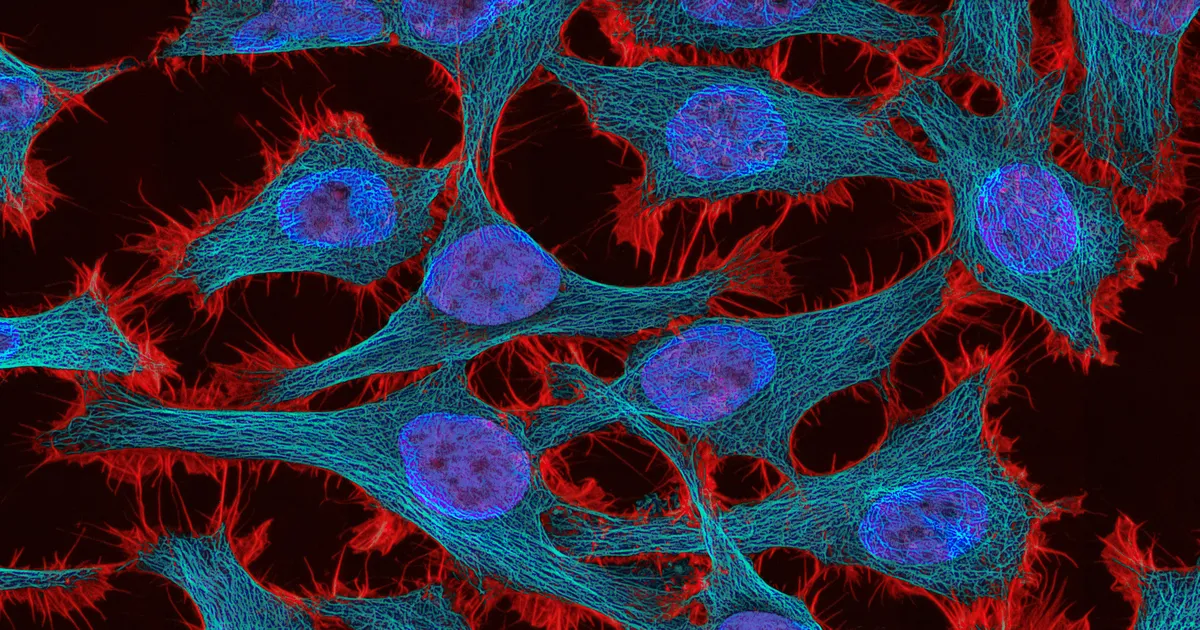 LÄBIMURRE VÄHIUURINGUTES ⟩ Selgus, miks vähirakud lõputult jagunevad