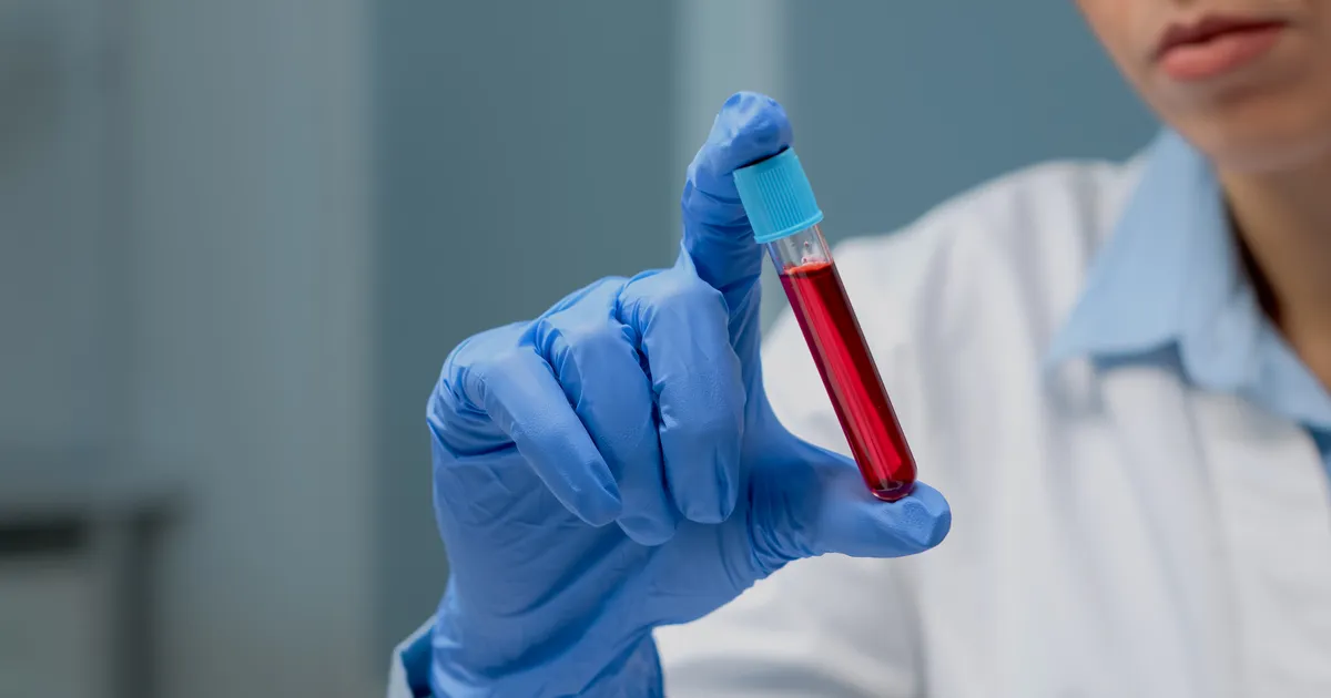 PÖÖRDELINE LEID ⟩ Lihtne vereanalüüs ennustab surmariski 10 aastat ette