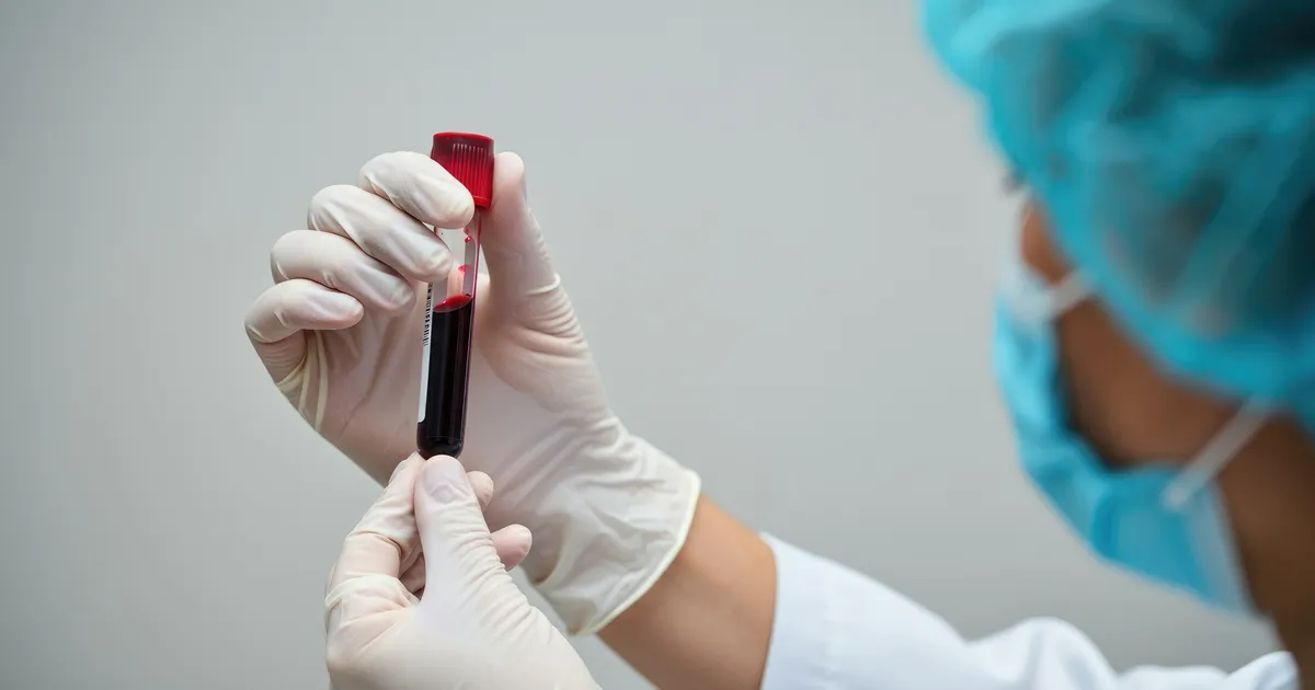 50 miljonit nakatunut: uus kiirtest annab vastuse 15 minutiga