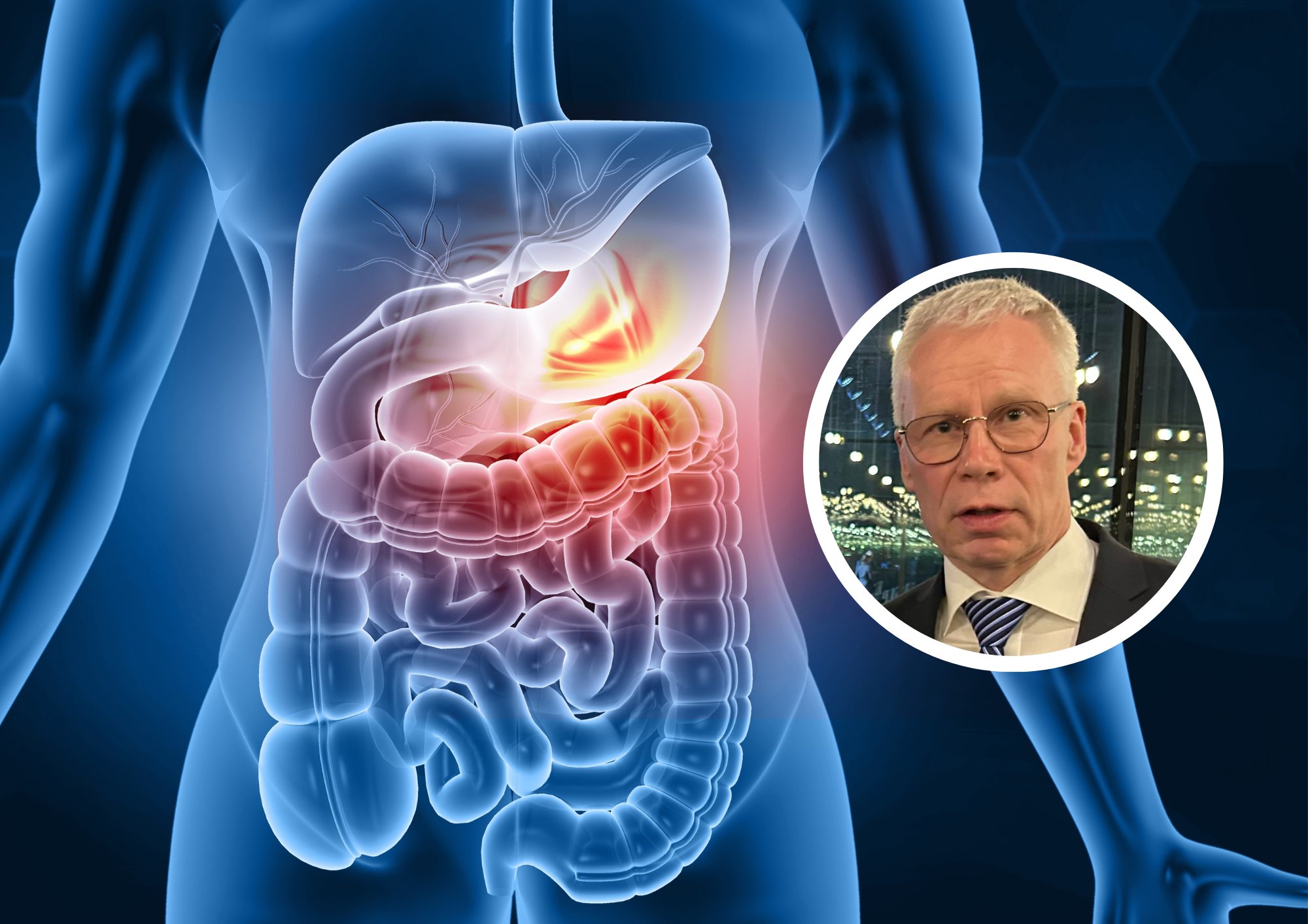 USUTLUS | Kas soolestik vajab puhkust ja puhastamist? Gastroenteroloog: see on inimesele väga ebaloomulik asi