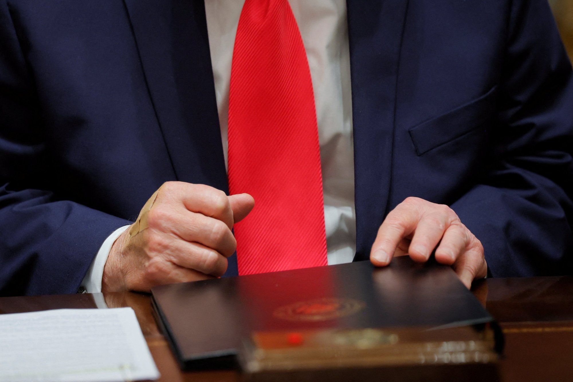 FOTOD | Silmatorkavad plaastrid! Trumpi käsi pälvis taas ohtralt tähelepanu