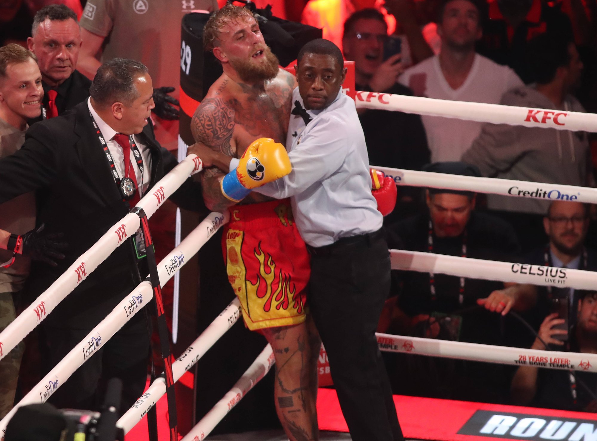 FOTO | Anthony Joshualt kolki saanud Jake Paul jagas pilti murtud lõualuust. „Tooge Canelo järgmisena“