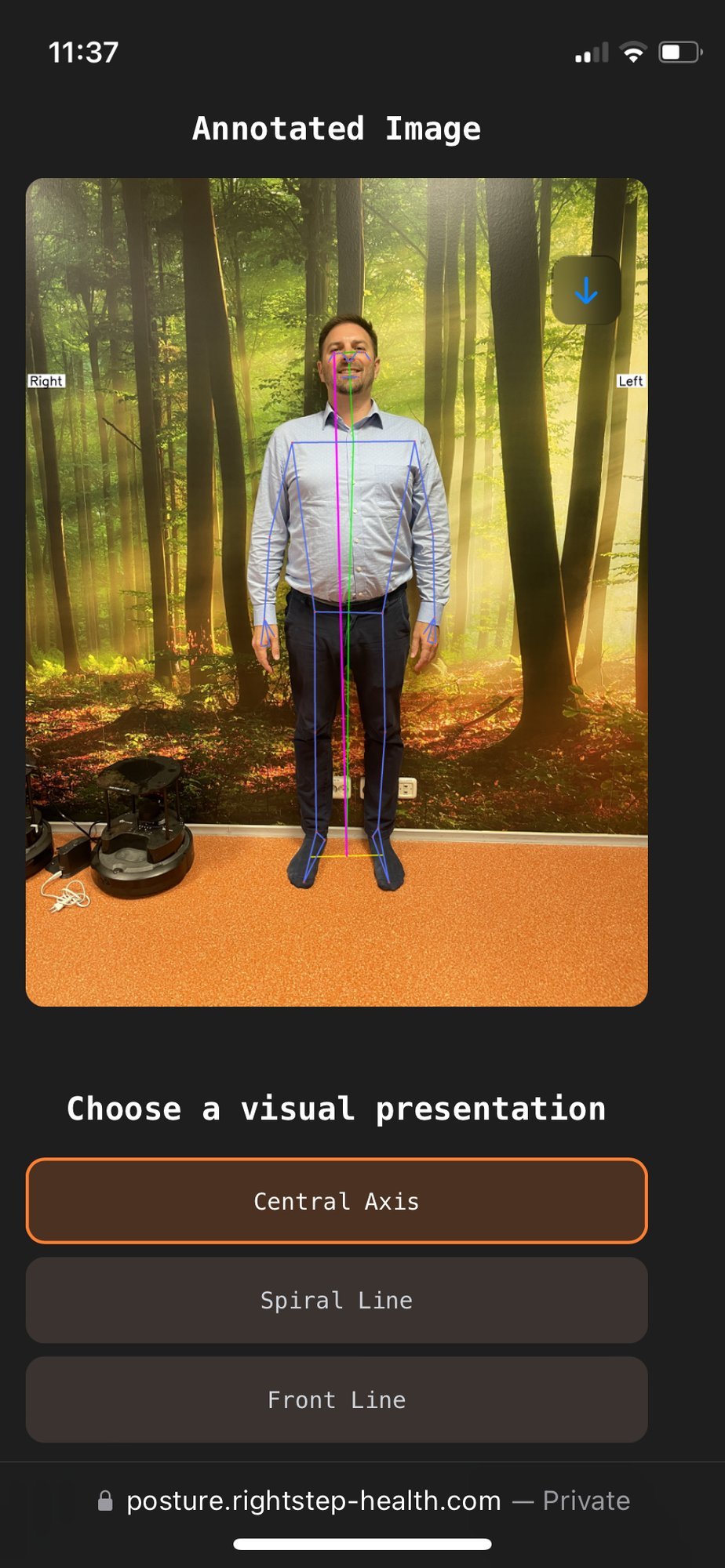 Selg sirgu! TalTechis loodud äpp tuvastab rühivead ühe ainsa foto põhjal