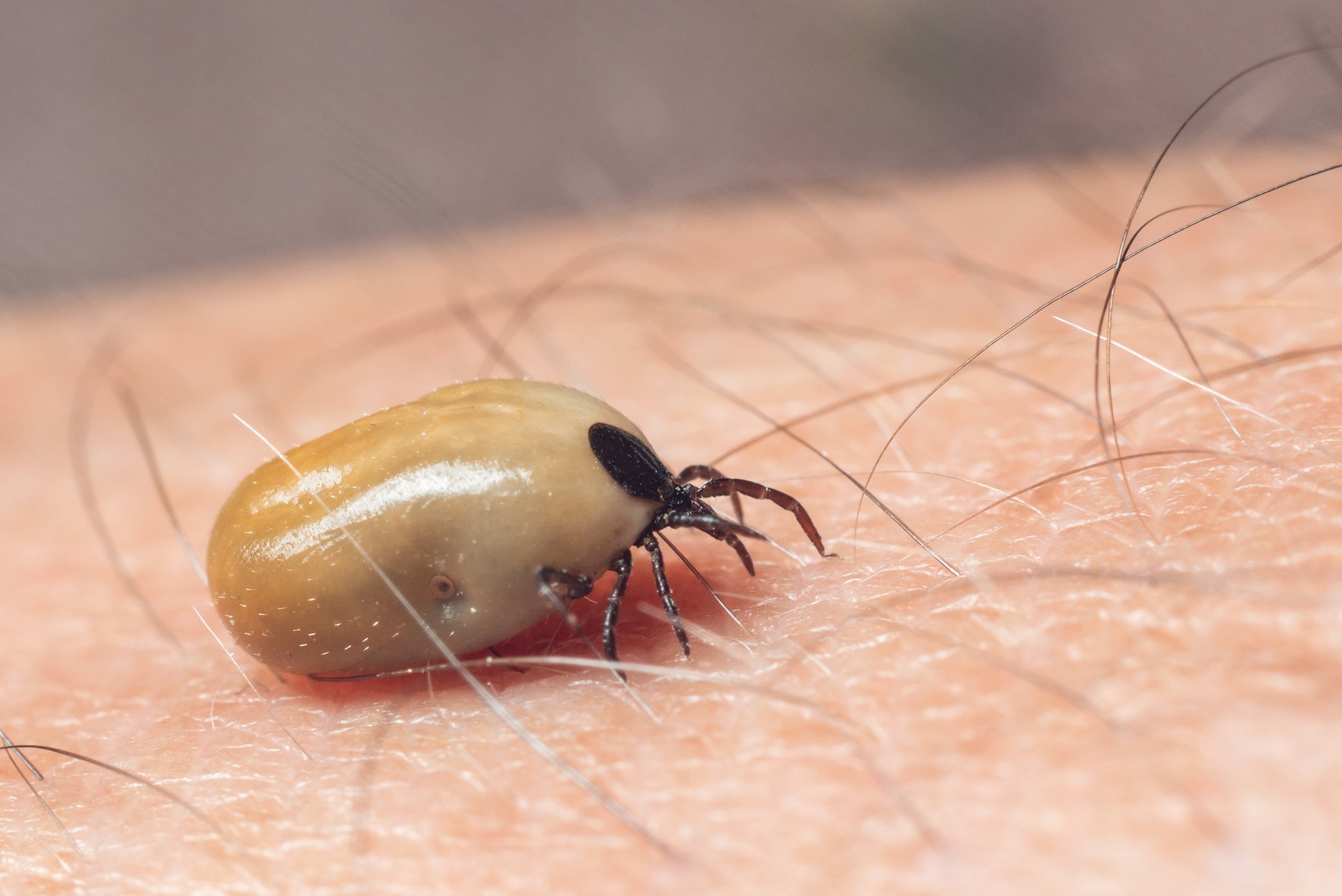 Üle 3300 puugihaiguse juhu sel aastal. Millised on Eesti kõige puugirikkamad piirkonnad?