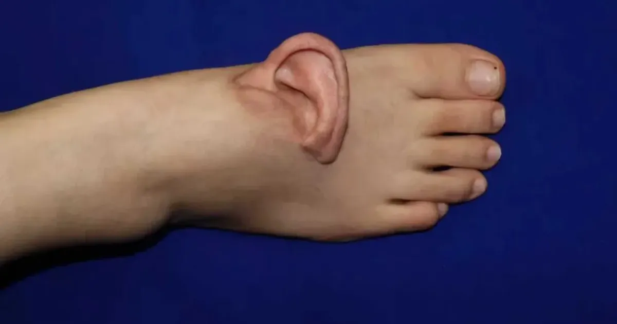 Sellele hiina naisele õmmeldi kõrv jala külge – miks küll?