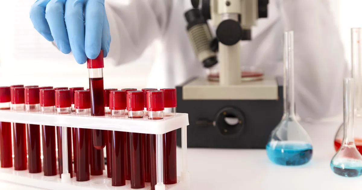 HOIATUS ⟩ Eestis tõstab pead salakaval nakkus