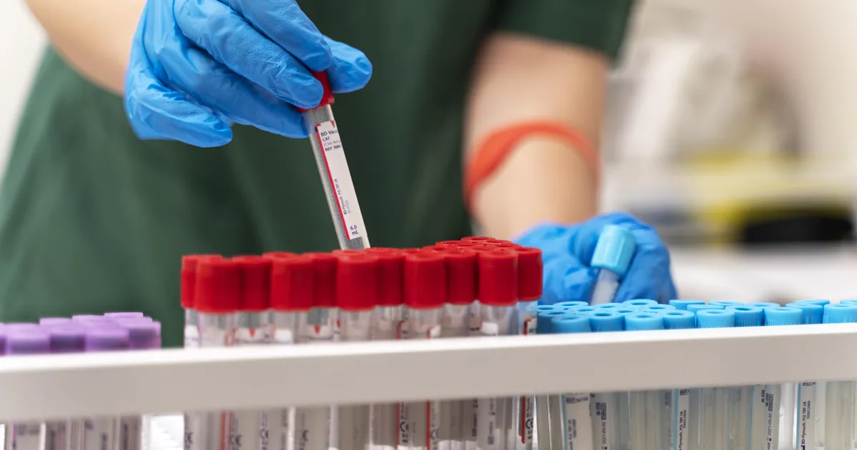 Uus statistika: igal kolmandal töötajal avastatakse varjatud tervisemure