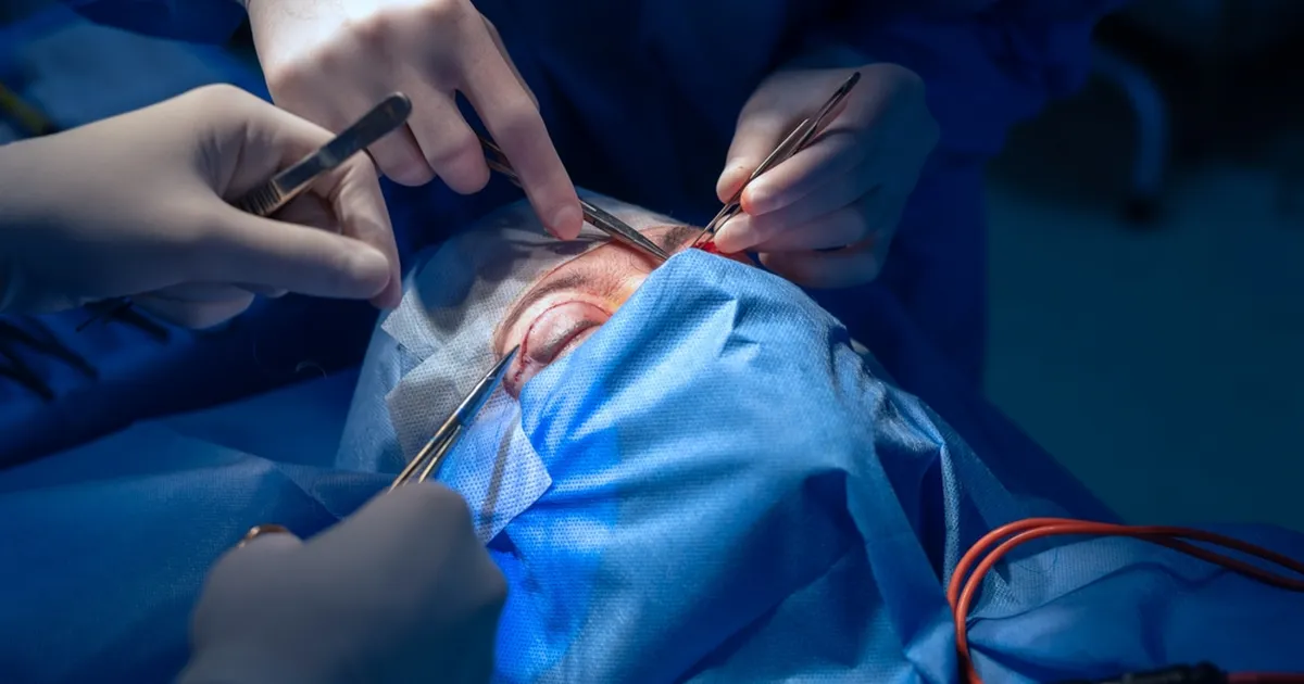 MÜÜDIMURDJA ⟩ Valearusaamad ilukirurgiast tekitavad eestlannades ebarealistlikke ootusi