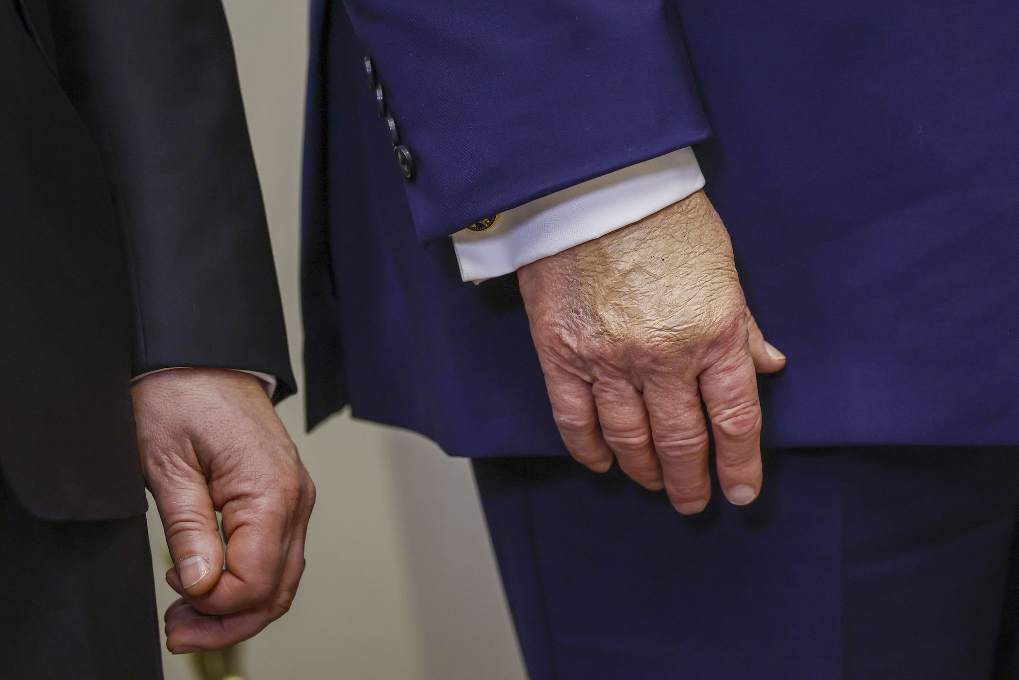 Trump ütles, et võtab vere vedeldamiseks rohkem aspiriini, kui arstid soovitavad