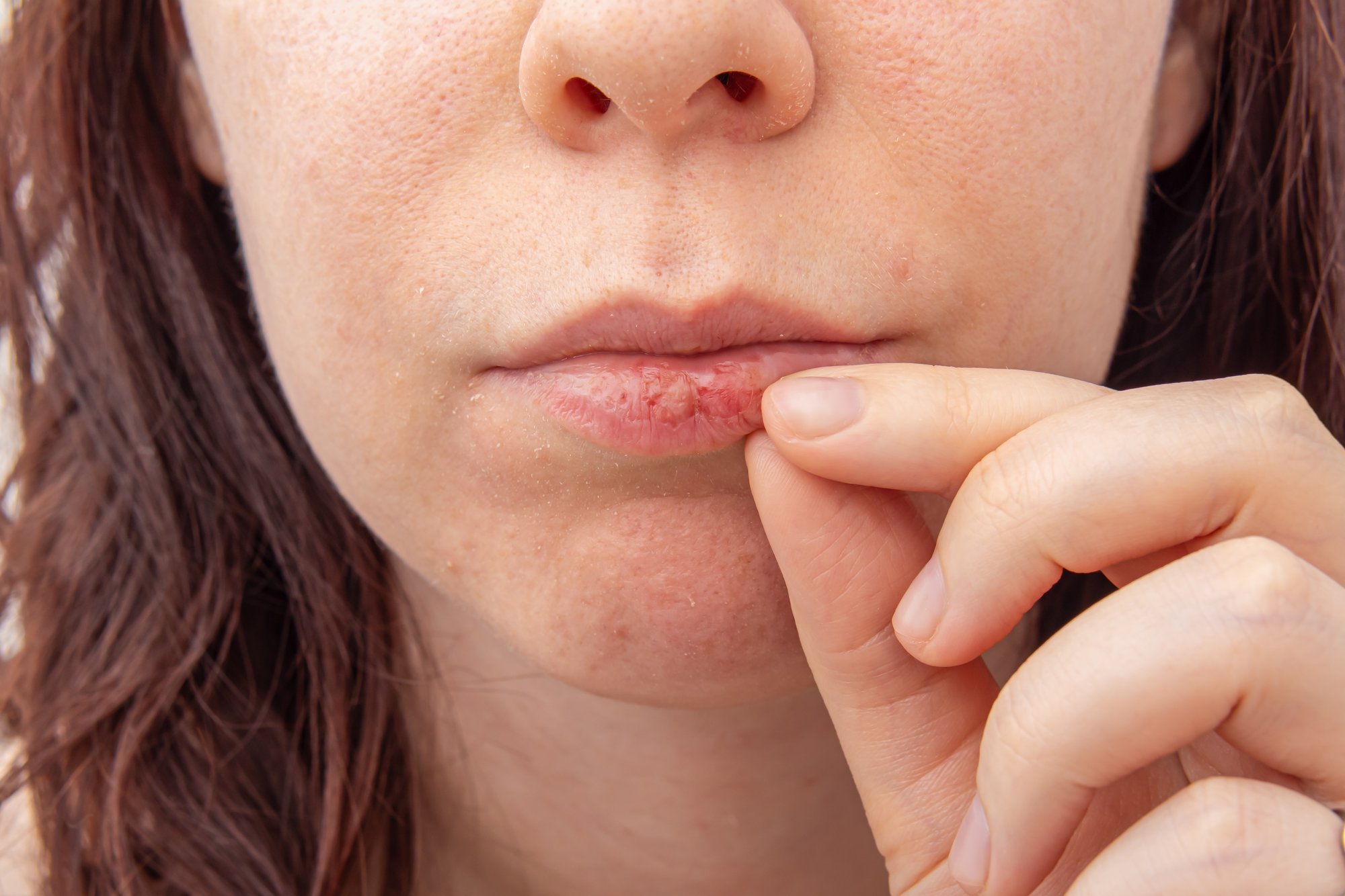 Vajalikud abivahendid köögikapist! Lõhenenud ja kuivade huulte vastu võivad aidata roheline tee ja must leib