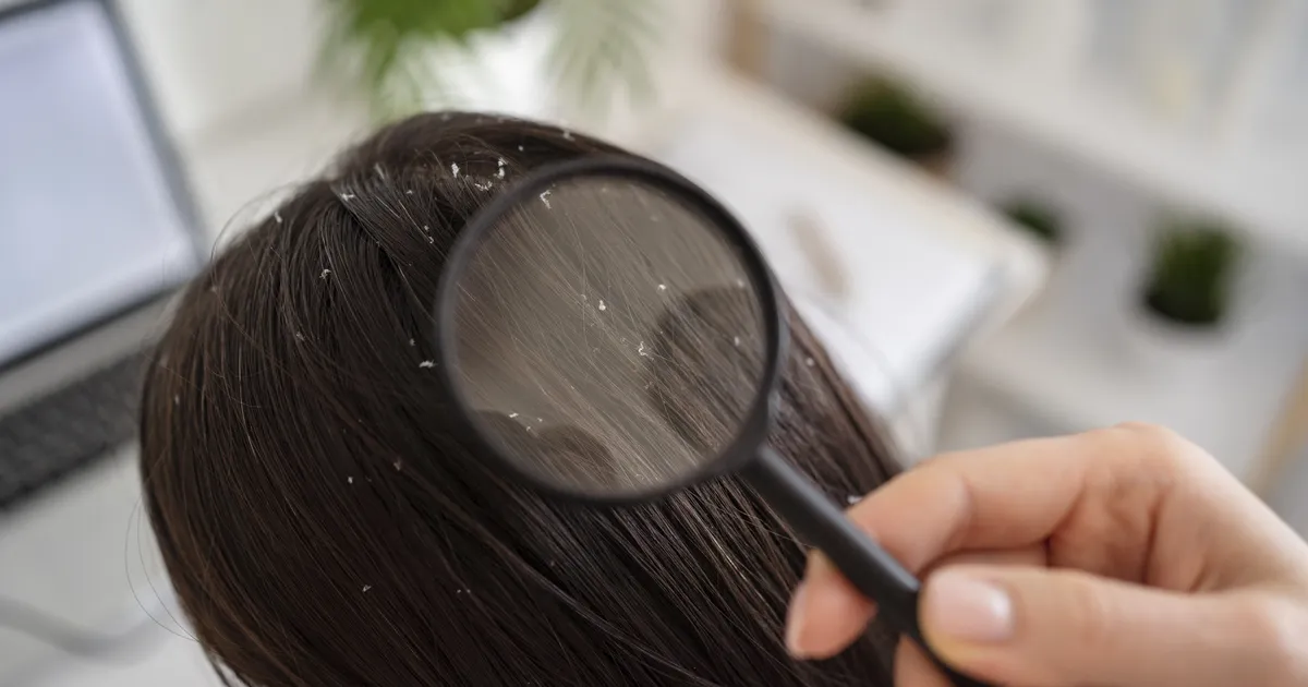 TRAAGILINE JUHTUM ⟩ 12-aastane tüdruk suri täide põhjustatud tüsistustesse