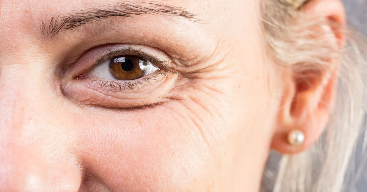 Uus ilutrend vallutab maailma: unusta peitepulk, silmaalused kotid on nüüd moes!