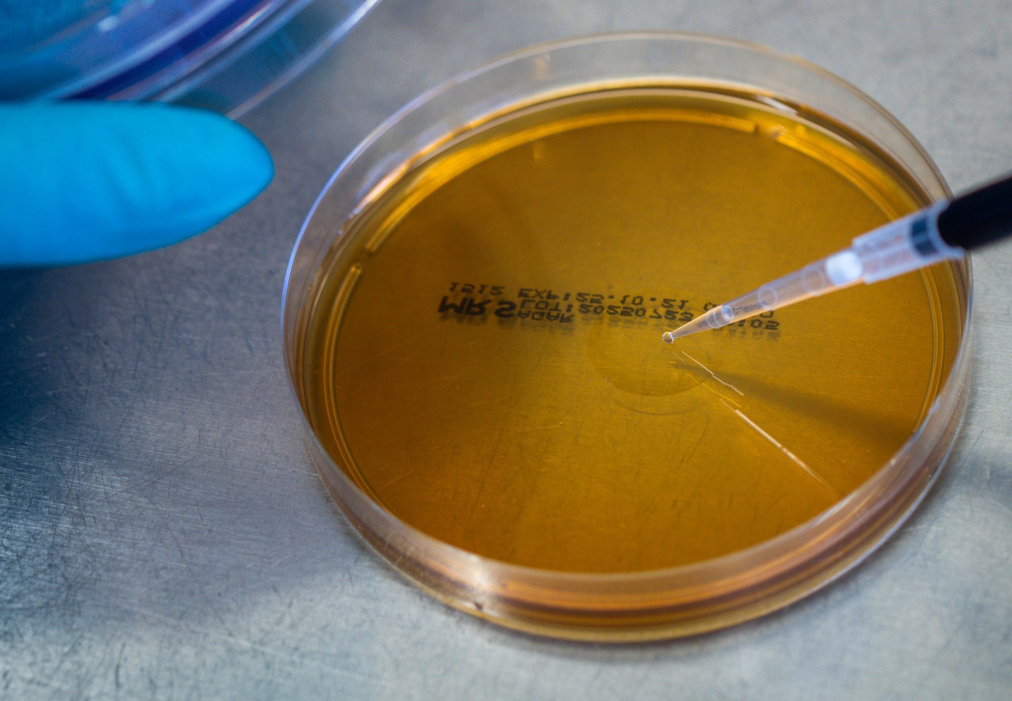 Rumeenia koopast leitud bakterid osutusid resistentseks 10 antibiootikumi suhtes