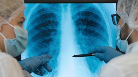 Viirusnakkus põetud, aga oht alles ees: uus uuring seob raske COVIDi ja gripi levinud haiguse riskiga