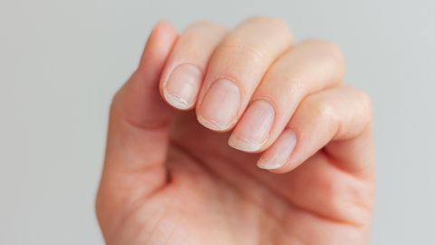 Väike muutus küüntel võib olla eluohtlik: vaata, milliseid märke ei tohi kunagi ignoreerida