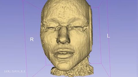 VÕTAB SÕNATUKS ⟩ Arst näitab, mis ilusüstidega naha all tegelikult juhtub