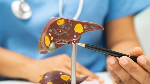 Esimesed märgid, et alkohol on hakanud maksale liiga tegema