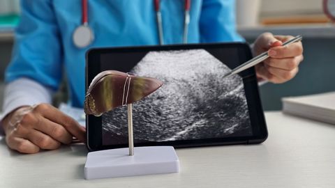 ARST HOIATAB ⟩ See vaikne haigus laastab märkamatult eestlaste maksa