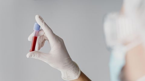 UURING ⟩ Just selle veregrupiga inimestel on suurem diabeedirisk