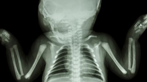 Uurijad hämmingus: kes mähkis 18. sajandi poisi jäänused 1910. aasta lehte ja peitis ta põranda alla