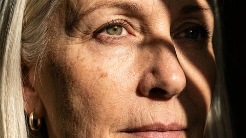 E-vitamiini puudus võib põhjustada probleeme olulise elundiga