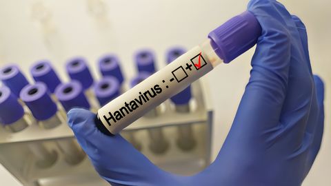 Epidemioloogid ei paanitse: miks tappev hantaviirus ei muutu järgmiseks pandeemiaks