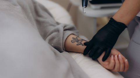 VAEVALINE JA VALUS ⟩ Nooruses tehtud või vanglas saadud tätoveeringutest on võimalik lahti saada, aga see võib võtta palju aega
