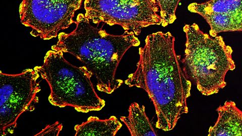 Kvantbiosensor – sellega näeb rakkudes toimuvaid nanotasandi muutusi