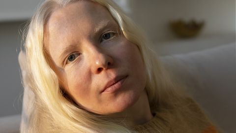 Puhkus Kreekas hävitas naise elu: ta tunneb lähedased nägupidi ära, aga nimesid enam ei mäleta